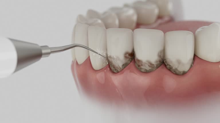 Trusted Tooth Extraction service in Sanibel, FL - Dentist Open Now